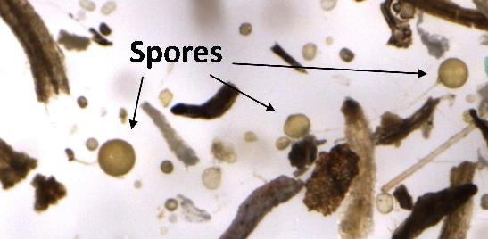 AMF Spores